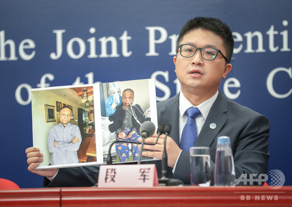 新型コロナ治療の薬で皮膚が黒くなった医師、状態改善 中国・武漢 新型コロナ治療の薬で皮膚が黒くなった医師、状態改善 中国・武漢