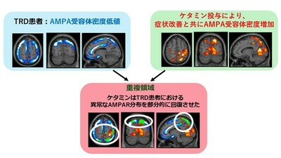【横浜市立大学】ケタミンがうつ症状を改善する仕組みを解明