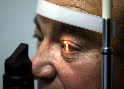 人工網膜システム、米で認可へ 網膜色素変性症の患者に光