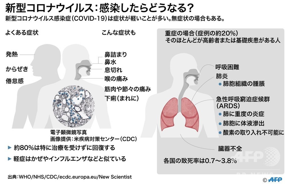 図解新型コロナウイルスはどのように伝染するのか 写真6枚 国際ニュースafpbb news