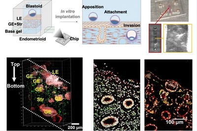 中国と外国の共同チーム ヒト胚着床過程を実験室で初めて再現