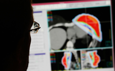 がんの原因、遺伝や環境でなく「不運」が大半 米研究