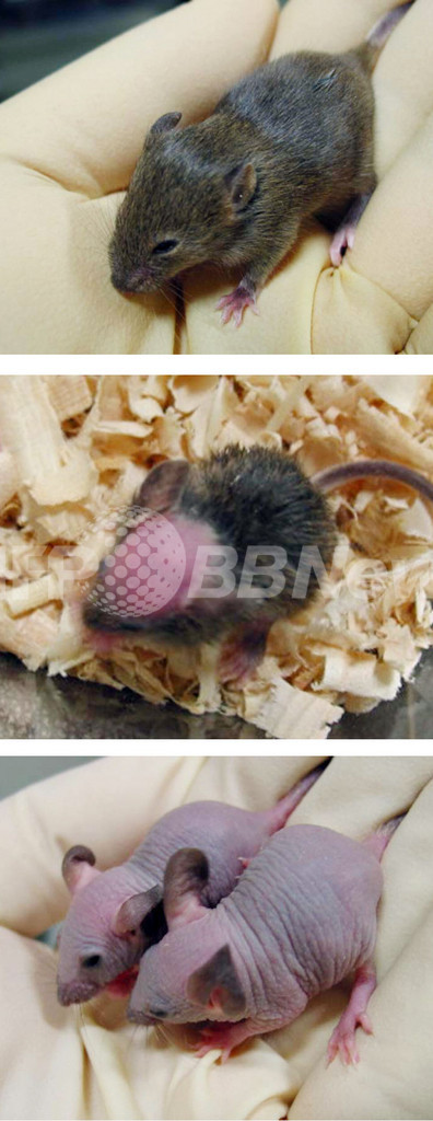 脱毛の原因遺伝子を特定、国立遺伝学研究所と慶応大の研究チーム 脱毛の原因遺伝子を特定、国立遺伝学研究所と慶応大の研究チーム