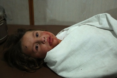 シリア軍攻撃で子どもら19人死亡 首都近郊の反体制派地区