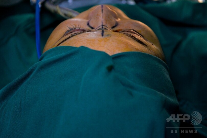 「欧米人みたいな鼻にしたい」 中国で美容整形ブーム