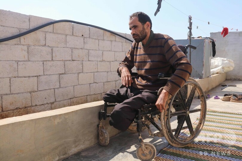 両脚両目も失った…体に刻まれる「紛争の地図」 シリア内戦10年目