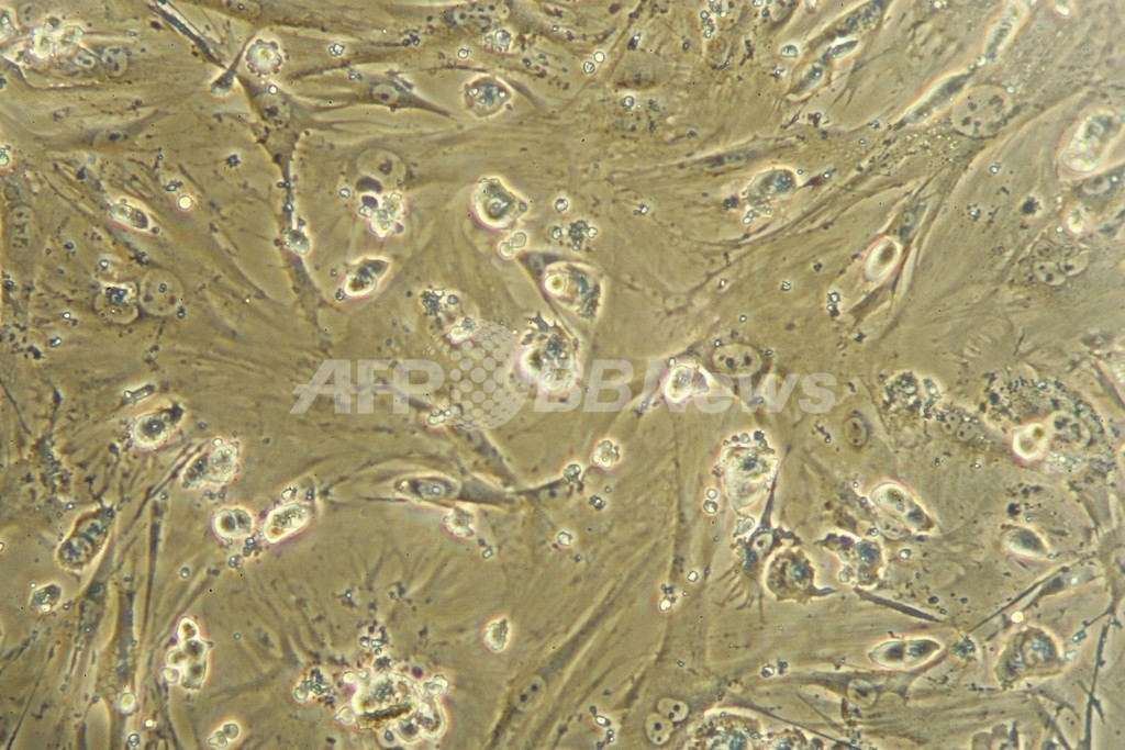ES細胞から大量の赤血球を生成、輸血用血液の無限供給も可能か ES細胞から大量の赤血球を生成、輸血用血液の無限供給も可能か