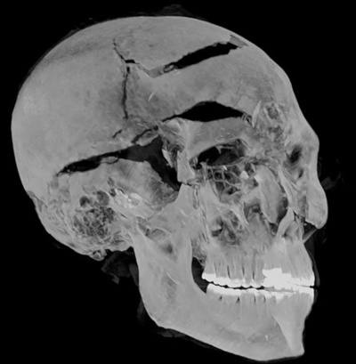 3600年前のファラオの死因、先端技術でついに解明 エジプト
