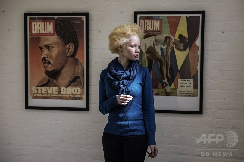 アルビノへの偏見乗り越えモデルに、南アのタンド・ホパさん