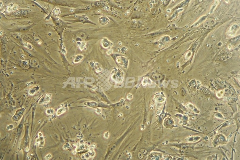 ES細胞から大量の赤血球を生成、輸血用血液の無限供給も可能か ES細胞から大量の赤血球を生成、輸血用血液の無限供給も可能か