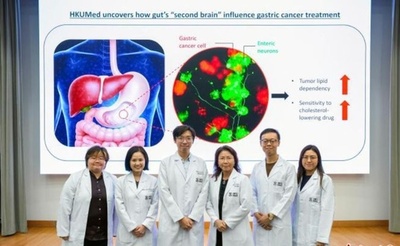 香港大学医学部が胃がん代謝の「暗号」を解読 腫瘍成長を65%抑制