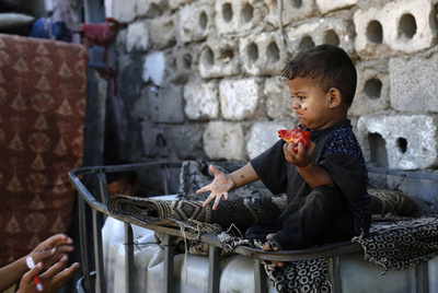 5歳未満の子ども、3人に1人が栄養不良か過体重 ユニセフ