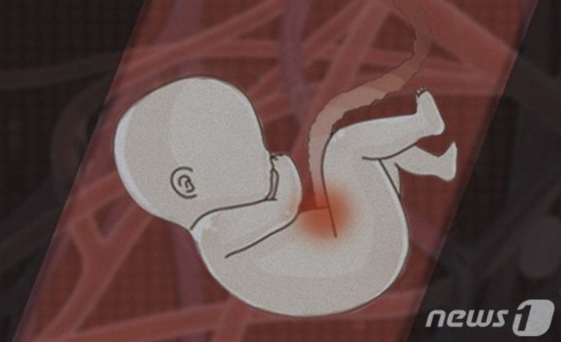 (c)news1