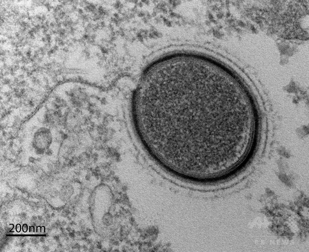 3万年前の新種巨大ウイルス蘇生へ、シベリア永久凍土で発見 研究 3万年前の新種巨大ウイルス蘇生へ、シベリア永久凍土で発見 研究