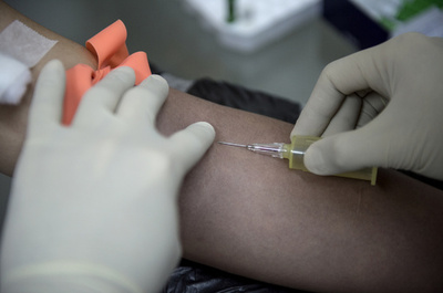 結核を数時間で診断、新たな血液検査法 米研究