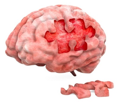 韓国・認知症患者が増えているのに…増えない診断インフラ