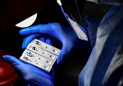 新型コロナ、数か月以内に免疫消失か 研究