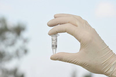 新たな遺伝コードを発見、遺伝子制御に関与か 国際研究