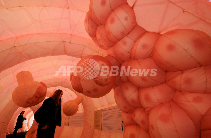 巨大な「腸」のアート、ドレスデンで展示