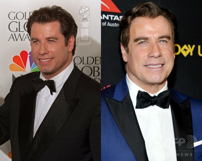 【写真特集】海外男性セレブのビフォーアフター