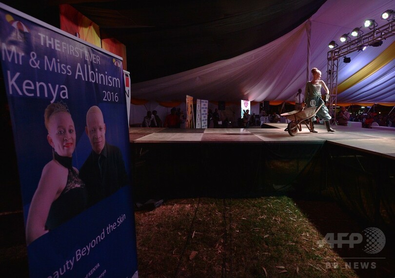 アルビノのコンテスト、偏見に立ち向かい美しさ競う ケニア