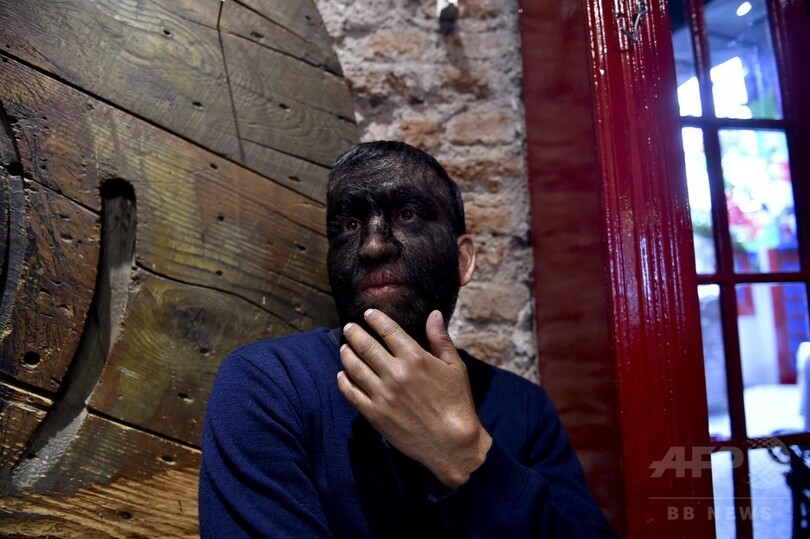 孤独と闘う「オオカミ男」、新たな人生への決意 メキシコ