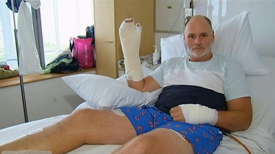 動画：豪男性、ワニの目に指突っ込んで危機脱出 病室で会見