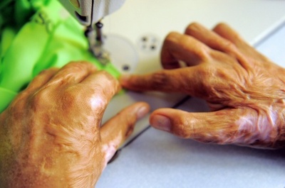 若い女性に硫酸、男2人を逮捕 ドイツ