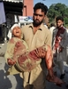 パキスタン・ペシャワル（Peshawar）北方のチャルサダ（Charsadda）地区で起きた2件の爆弾攻撃で負傷し、病院に運ばれる少年（2011年5月13日撮影）。(c)AFP/HASHAM AHMED