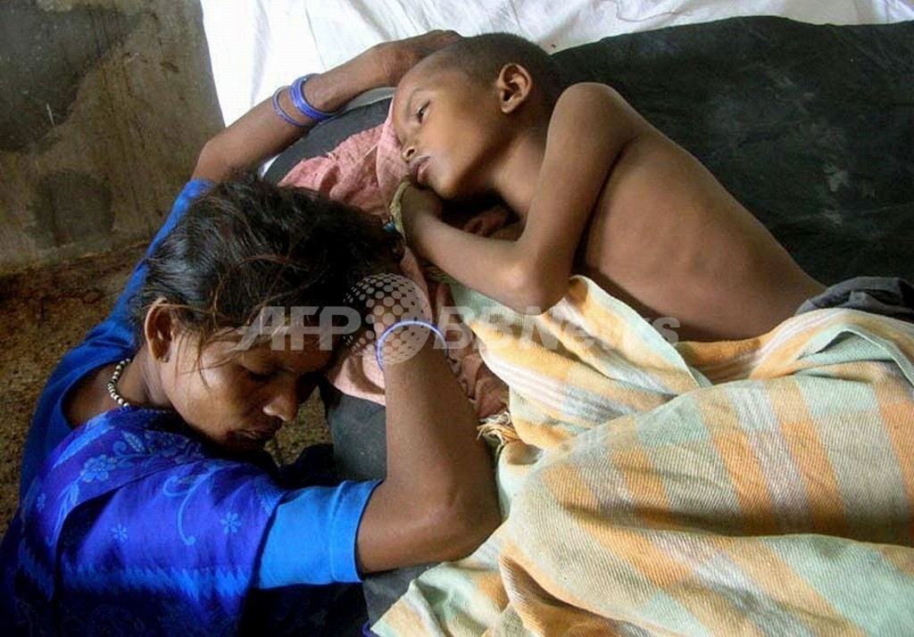 インド北部で日本脳炎が流行、200人近く死亡 インド北部で日本脳炎が流行、200人近く死亡