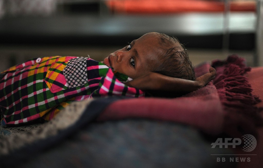 発育不全の子ども、インドで世界最多 屋外排せつと不衛生で 発育不全の子ども、インドで世界最多 屋外排せつと不衛生で
