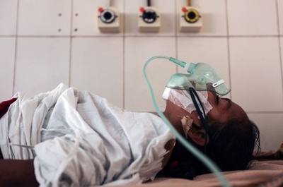 「樹木男症候群」発症とみられる少女、イボ除去手術成功 バングラ