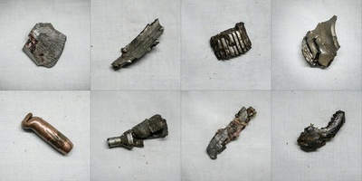 銃弾や金属片 ウクライナ負傷兵の体内から摘出