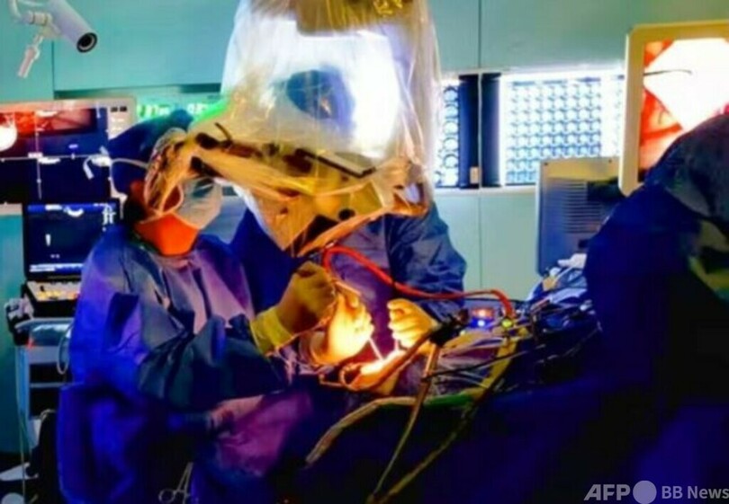 中国が独自開発したブレイン・マシン・インタフェース 脳深部腫瘍の境界精密位置特定の臨床試験に成功