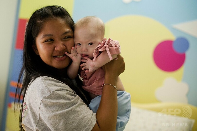 ダウン症児拒否 は誤解 代理出産依頼の豪夫婦が反論 写真5枚 国際ニュース Afpbb News