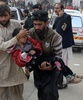 パキスタン北西部ペシャワル（Peshawar）で、イスラム武装勢力による襲撃があった学校で負傷し、病院に運ばれる女子生徒（2014年12月16日撮影）。(c)AFP/A MAJEED
