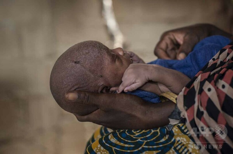 【AFP記者コラム】アフリカ経済大国の飢餓、ナイジェリアの避難民キャンプ