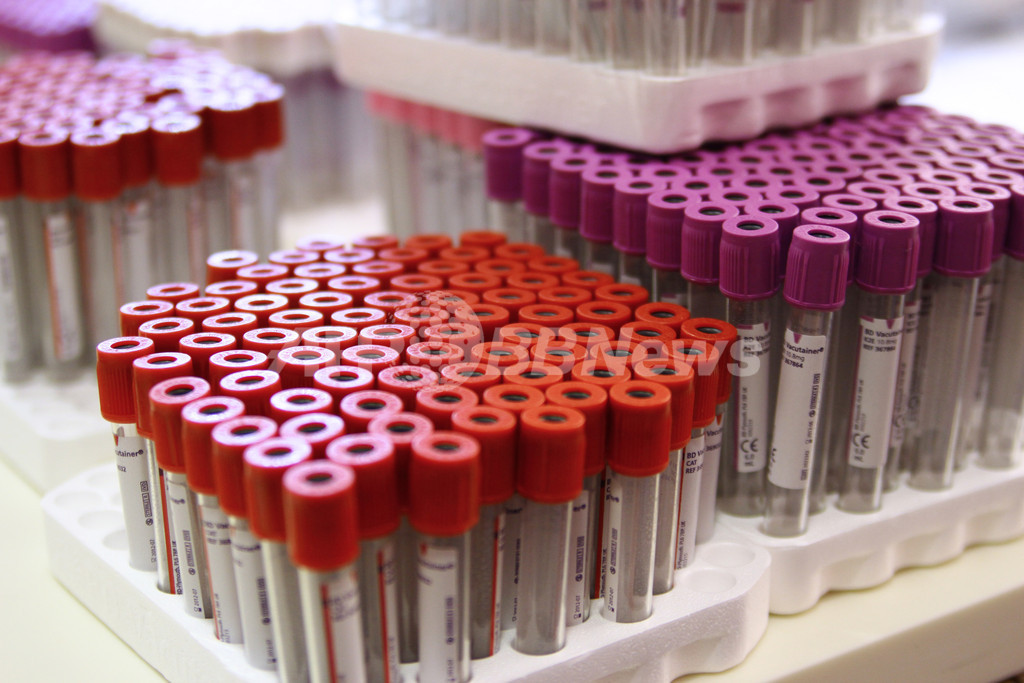 治癒期待されたHIV感染者2人、再び陽性に 治癒期待されたHIV感染者2人、再び陽性に