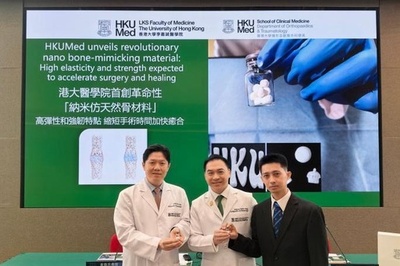 香港大学開発のナノ素材人工骨 骨欠損治療の難題解決へ