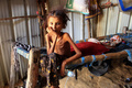 イエメン・ハッジャの国内避難民向けキャンプで生活する、体重10キロの10歳児（2021年1月23日撮影、資料写真）。(c)ESSA AHMED / AFP