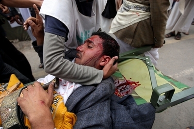 イエメン体制派がデモ隊に発砲、46人死亡 非常事態宣言