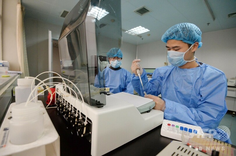 中国でHIV抗体から陽性反応、製品の使用停止と厳封処理を指示 国家衛健委