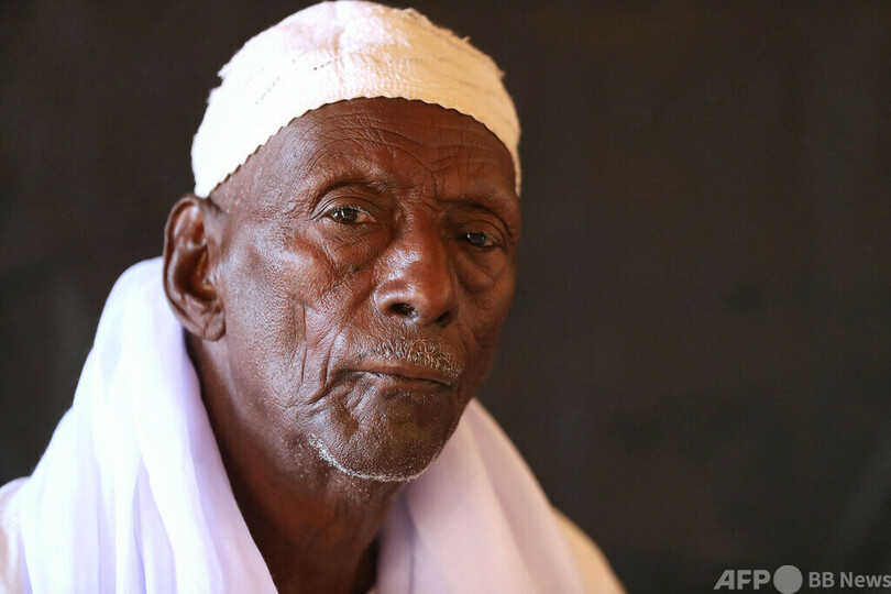 消えゆく風習、消えない顔の傷 スーダン