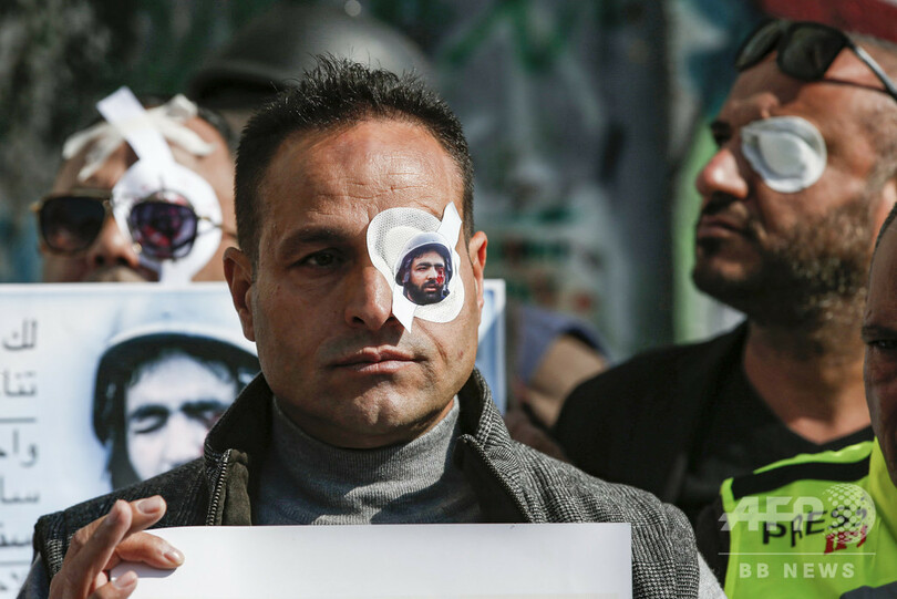 国際ニュース：AFPBB News取材中のパレスチナ人記者が片目失う、眼帯姿のジャーナリストら抗議デモ