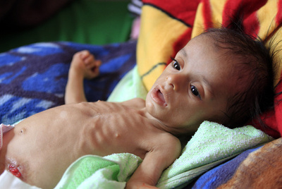 2018年国際支援の拠出要請、約2兆5400億円 国連