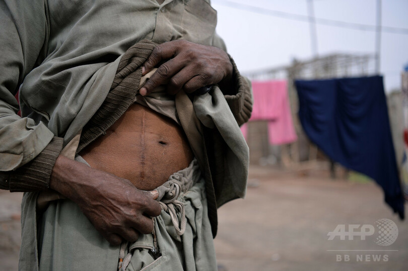 富と貧困が支える腎臓の違法取引 パキスタン 写真3枚 国際ニュース Afpbb News