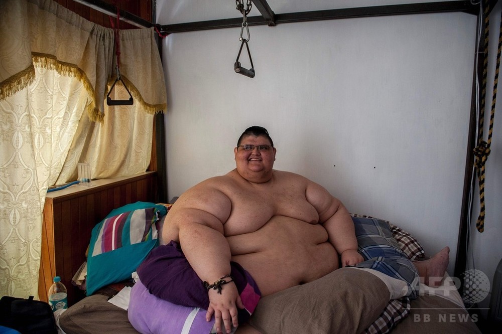 世界で最も重かった男性 170キロの減量に成功 メキシコ 写真6枚 国際ニュース Afpbb News