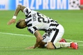 サッカー欧州チャンピオンズリーグ2014-15準々決勝第1戦、ユベントス対ASモナコ。落胆した様子をみせるユベントスのアルトゥーロ・ビダル（2015年4月14日撮影）。(c)AFP/OLIVIER MORIN