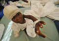 ハイチの首都ポルトープランス（Port-au-Prince）で、大地震で負傷し総合病院に収容された男の子（2010年1月23日撮影）。(c)AFP/Jewel SAMAD