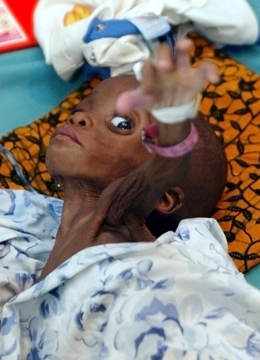 マラリアによる死者数、2006年は約100万人 WHO